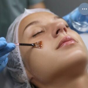 Tratamiento facial manchas